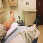 Done! Compound fracturesurgerycast offtherapyhardware outstitches outhead to the gym! hellip Done! Compound fracturesurgerycast offtherapyhardware outstitches outhead to the gym! hellip